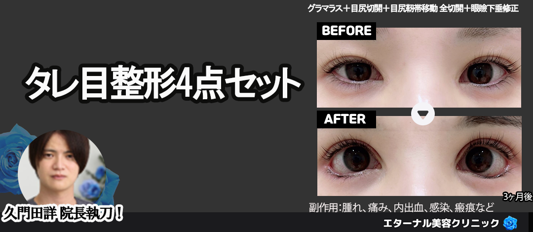 SDW HEROES 78代目武者頑駄無 レビューガンダムブログはじめました