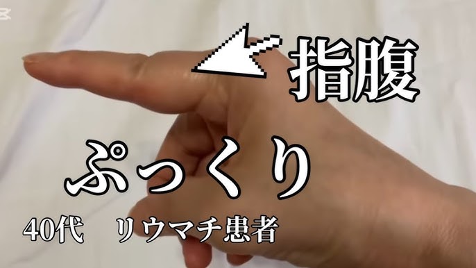 手相で指の腹の横線はストレス線？見方や意味・注意点を解説