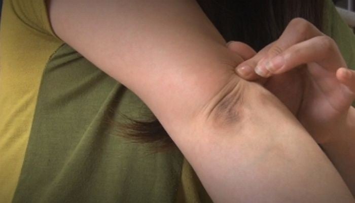 ほおづえをつくと、背骨がゆがみます座り仕事の疲れがぜんぶとれるコリほぐしストレッチダイヤモンド・オンライン