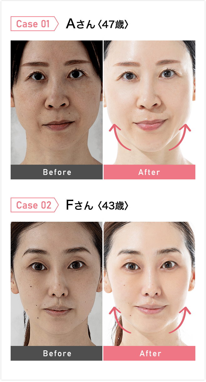 春のスキンケア！ 美容家石井美保の“肌アイロン”って？BeauTV ～VOCE ビューティーヴィ