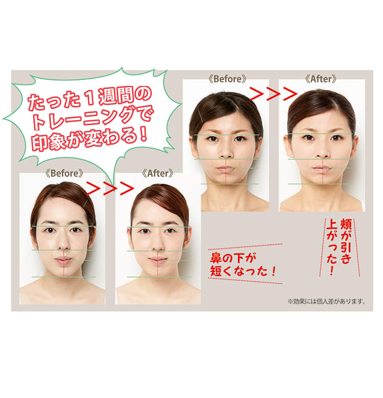 大人の頭の形矯正斜頭症についての様々な情報をお伝えいたします。斜頭症矯正ならべびきゅあ