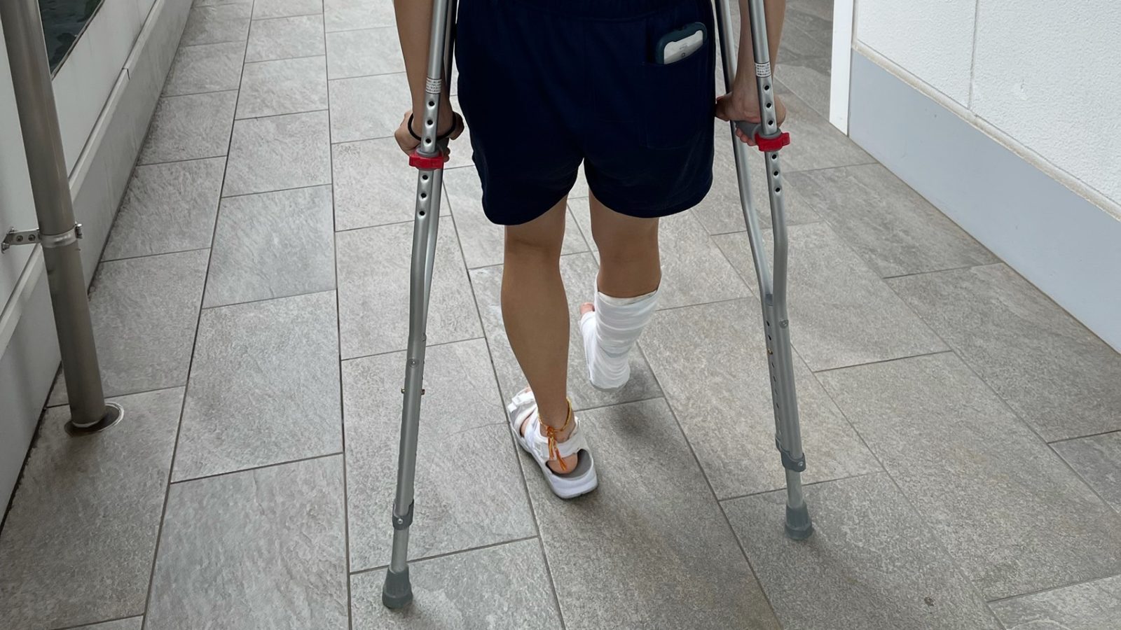 足の骨折と松葉杖 — ストック写真 © Richard_Pinder81807814