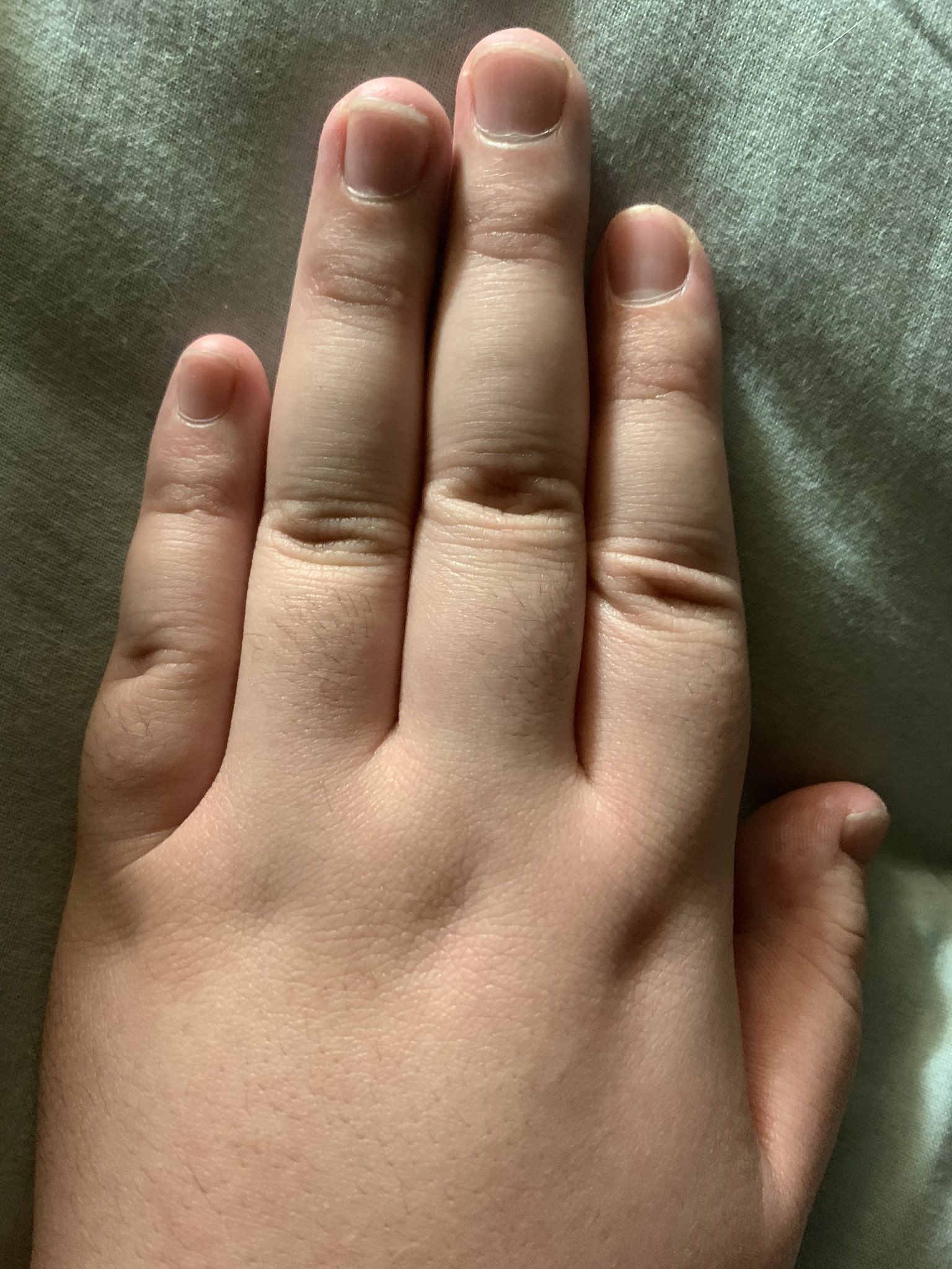 親指の手相の見方とは？ 付け根・第一関節の目が意味する運勢 手相占い 「マイナビウーマン」