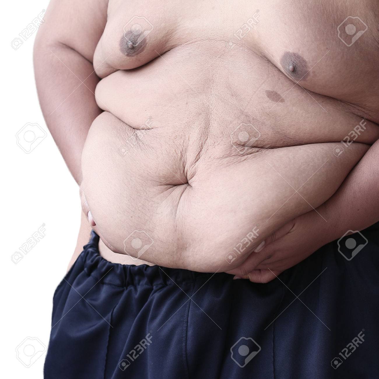 デブになってしまった男の話 1BUNCH COMICS