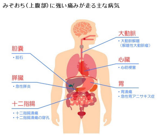 お腹を締め付けられるような痛みがある・原因と対処方法東京都千代田区の秋葉原・胃と大腸肛門の内視鏡クリニック千代田区院