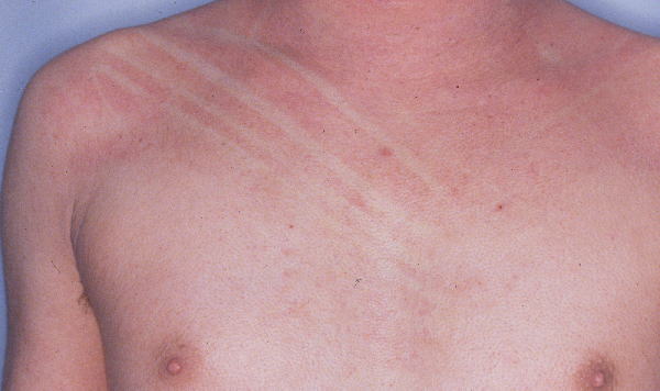 症状から一発診断！ 皮膚科専門医はこう見立てる株式会社総合医学社