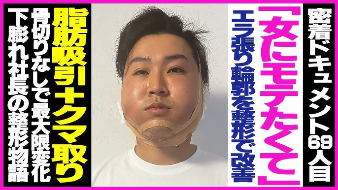 美容外科医監修 下膨れ顔をすっきりさせるおすすめケアや注意点を解説公式コラム美容整形・二重整形なら共立美容外科