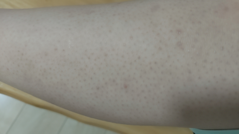 ヒゲ脱毛おすすめサロン・クリニック10選 2025年9月最新 口コミ高評価の人気店を徹底解説The Style Dictionary