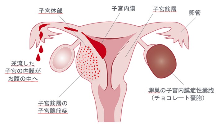 こころとからだの健康に効果的な「温灸器」を使った温活 山口薬品 中津市地元をダッシュするニュースサイト Z!mosh ジモッシュ！