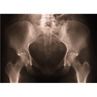 股関節・骨盤の画像診断 股関節・骨盤の画像診断川原康弘 本通販Amazon