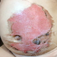 小さい子どもがいるママさん必見！軽度の傷・やけどはワセリンで処置できる子ども健栄生活