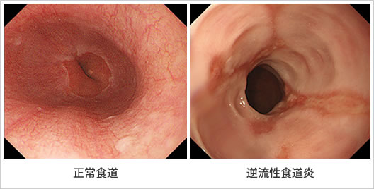胸の痛みの原因・考えられる病気は？草花クリニックあきる野市 内科 訪問診療 訪問リハビリ