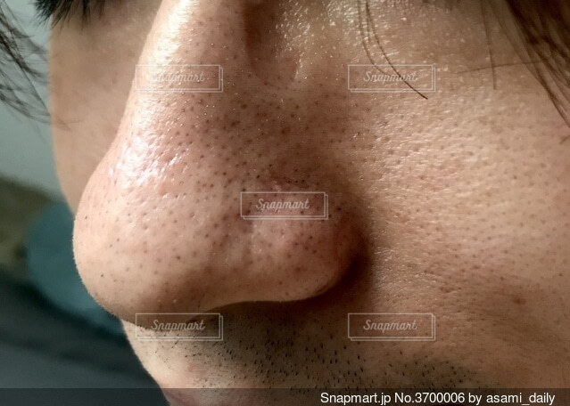 毛穴タイプ診断！自分の毛穴の種類がわからない時の簡単な見分け方オーガニック化粧品のピュアノーブル