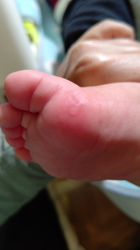 初めてのフルマラソンとマラソン後のケア銀座・日比谷の美容皮膚科 ゆかスキンクリニック