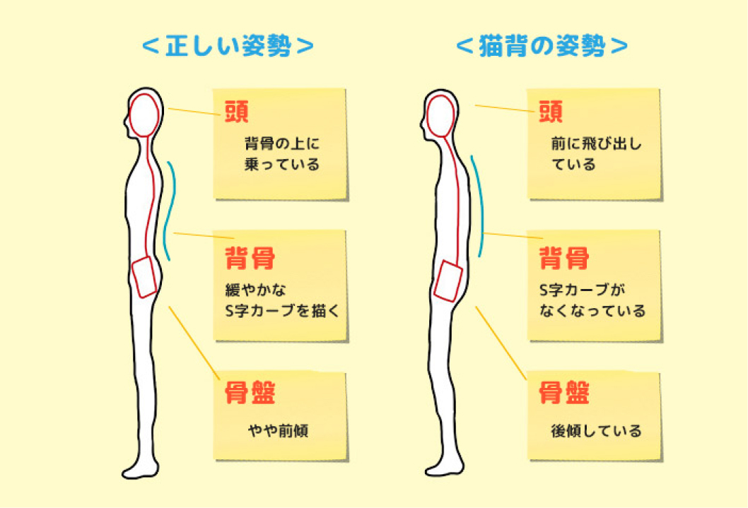 吉祥寺で猫背・巻肩でお悩みなら吉祥寺の整体みやびカイロプラクティック療院