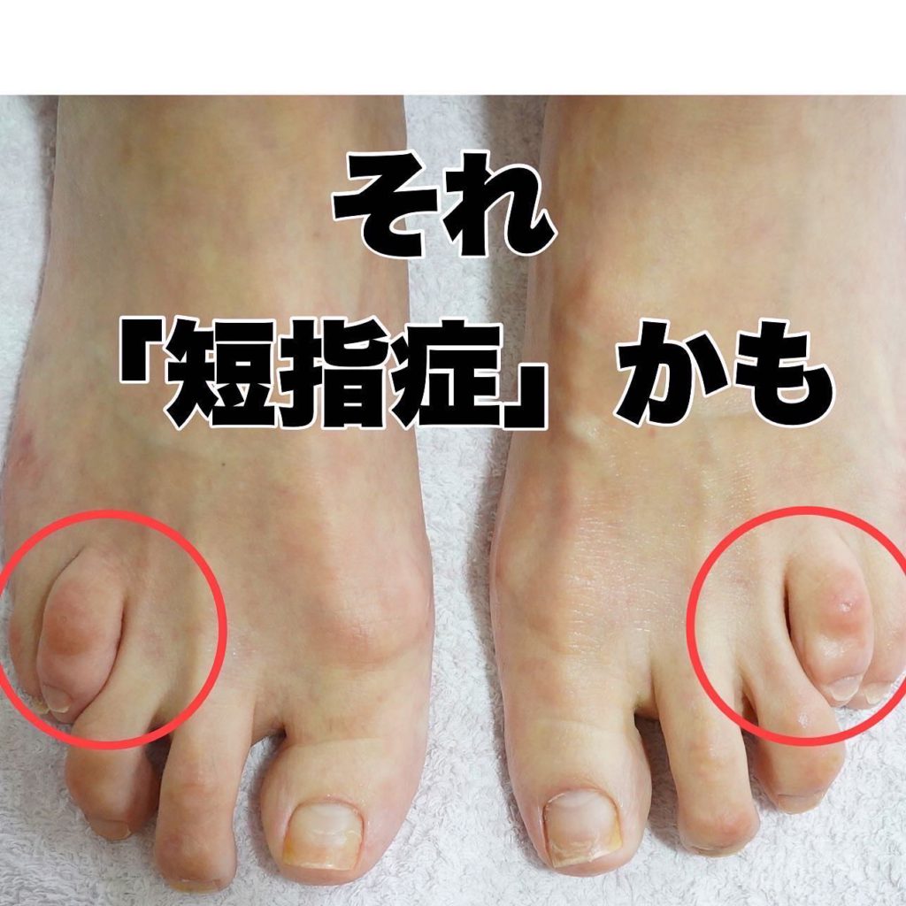 手相の指の意味は？長さや太さ、形の読み解き方について解説！日本占い師協会 JFTA