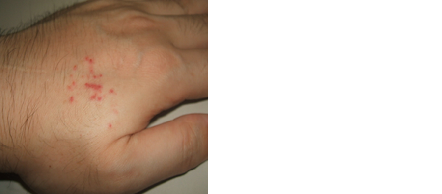 夢占い 蛇に噛まれる夢の意味とは？部位・種類別の暗示と宝くじの吉凶を解説！ - 占い情報まとめ-アムデレ女性の恋愛成就を叶えるメディア