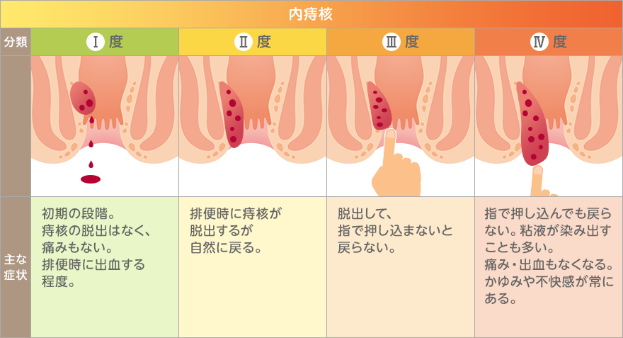 脱肛漢方の太陽堂漢薬局福岡市博多区