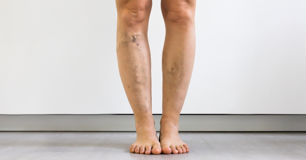 楽天市場 妊婦 足 の むくみ 解消 グッズの通販