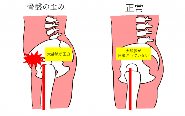 楽天市場 妊婦 足 の むくみ 解消 グッズの通販