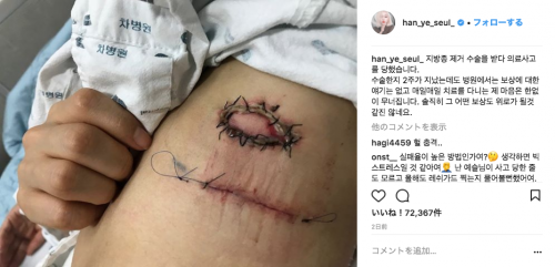 医療事故”で治療に専念中の女優ハン・イェスル、SNSでファンに感謝Infoseekニュース