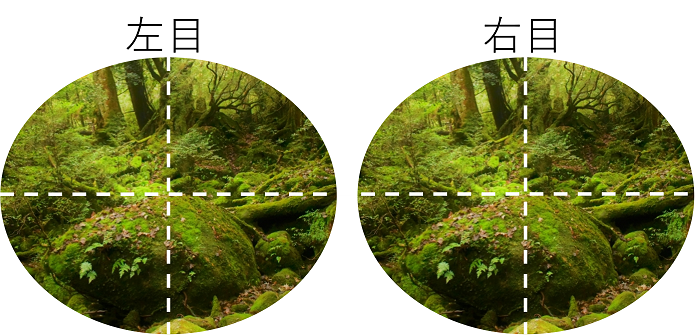 視野が欠ける・緑内障と定期健診の重要性とは