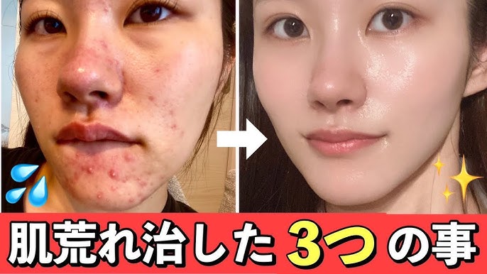 本気で肌を綺麗にしたい方必見！10個のケア方法を徹底解説ANS. magazine