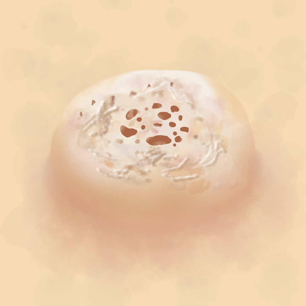 手や足のイボはウイルス性のことが多い