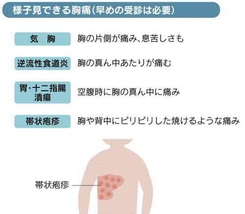 食道炎？長引く胸の違和感・痛み - 日本経済新聞