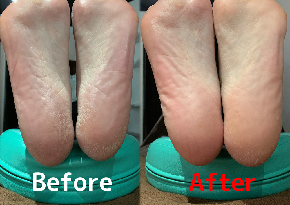 脚見せ”のための今どき美脚コスメ7選ビューティELLEエル デジタル