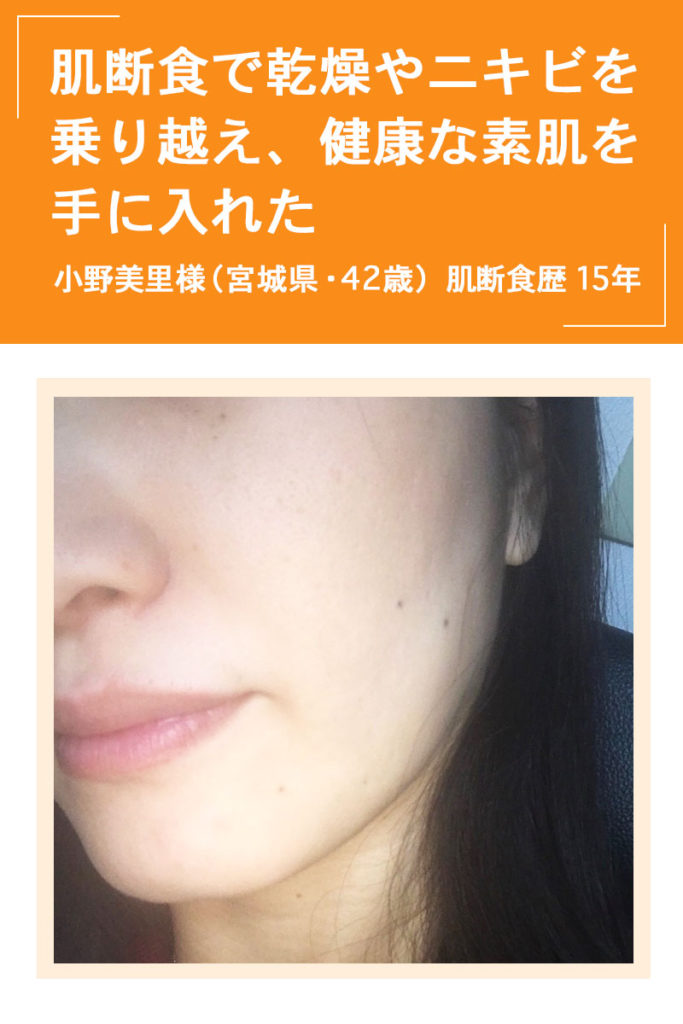 角質培養と肌断食で毛穴が小さくなった経過写真もち肌イブの肌断食ブログ