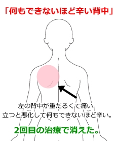 横になると呼吸が苦しくなり、上半身を起こすと呼吸が楽になるあなたの症状の原因と関連する病気をAIで無料チェック