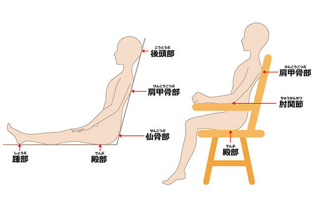 褥瘡 床ずれ とは？症状と処置方法​認知症ポータルサイト「テヲトル」