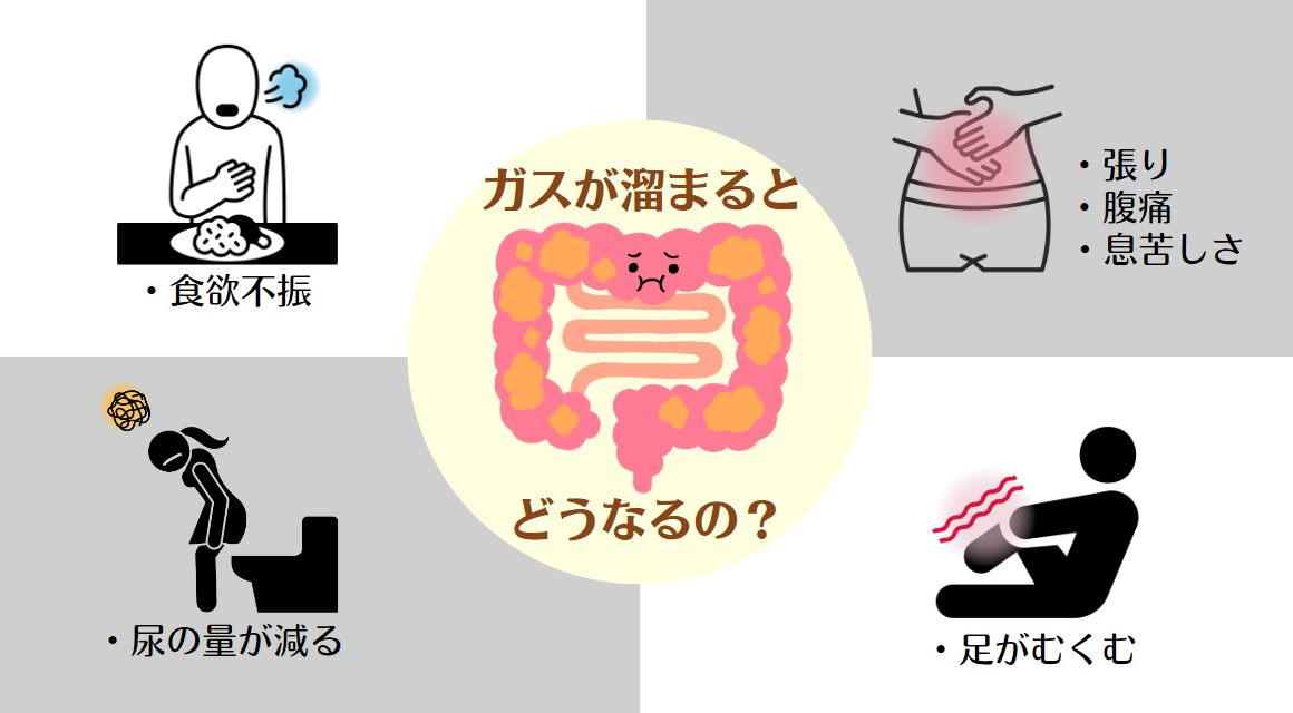 ぽっこりお腹と腰痛の関係性について 新中野 大木接骨院