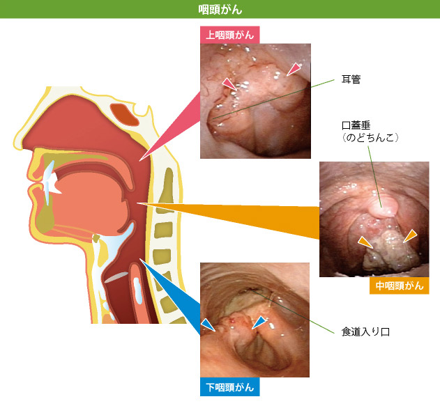 こどもの感染症