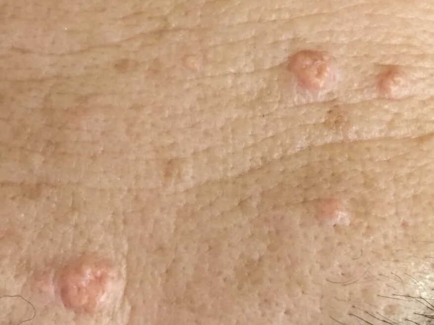 ほくろ・いぼ敏感肌も安心のくみこクリニック四条烏丸院 京都