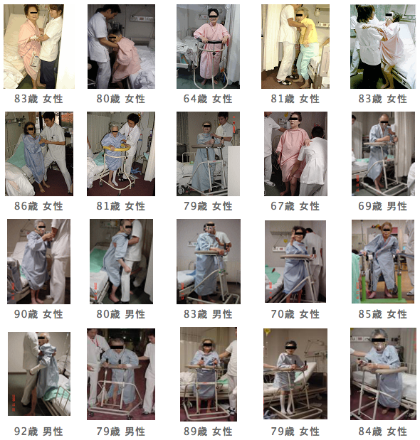 高齢者に多い大腿骨の骨折について⑦ 『手術療法③』MSコンディショニング