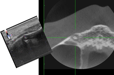 小型高画質超音波診断装置 MUS-P0303シリーズ医療ソリューション製品・サービスフジキンソフト株式会社