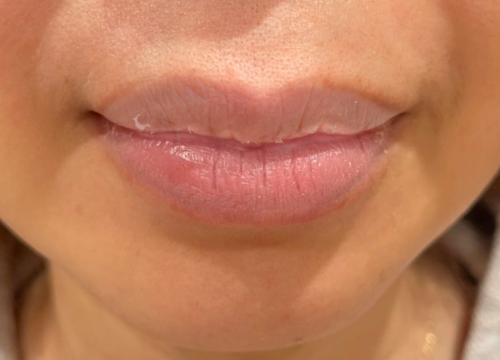 何年も前から唇の皮をむく癖がなおりません。やめようと思って少し我- 教えて！しごとの先生Yahoo!しごとカタログ