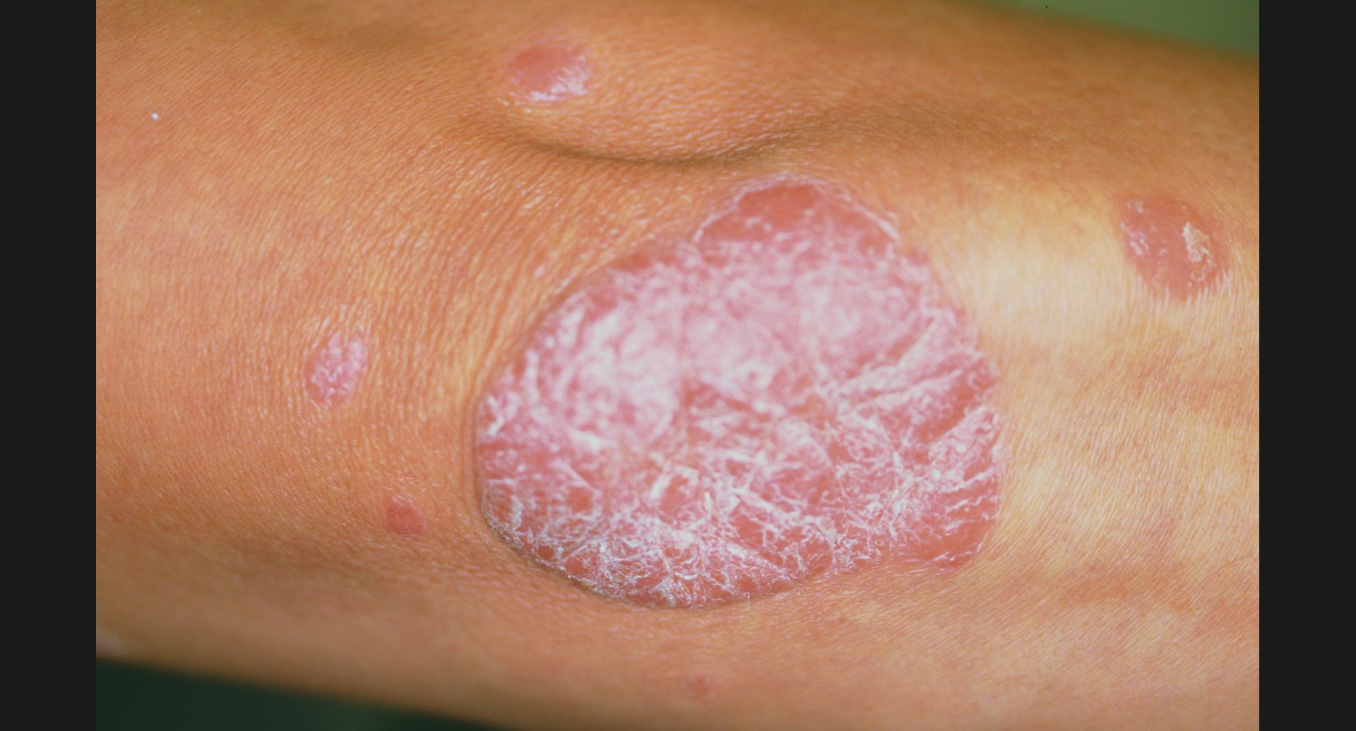 製品一覧皮膚のセルフケアサイト薬と健康を見つめる製薬会社 佐藤製薬株式会社