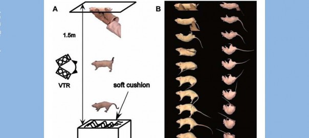 パーキンソン病 立ち直り反応が乏しい患者さんに対しての治療法3選