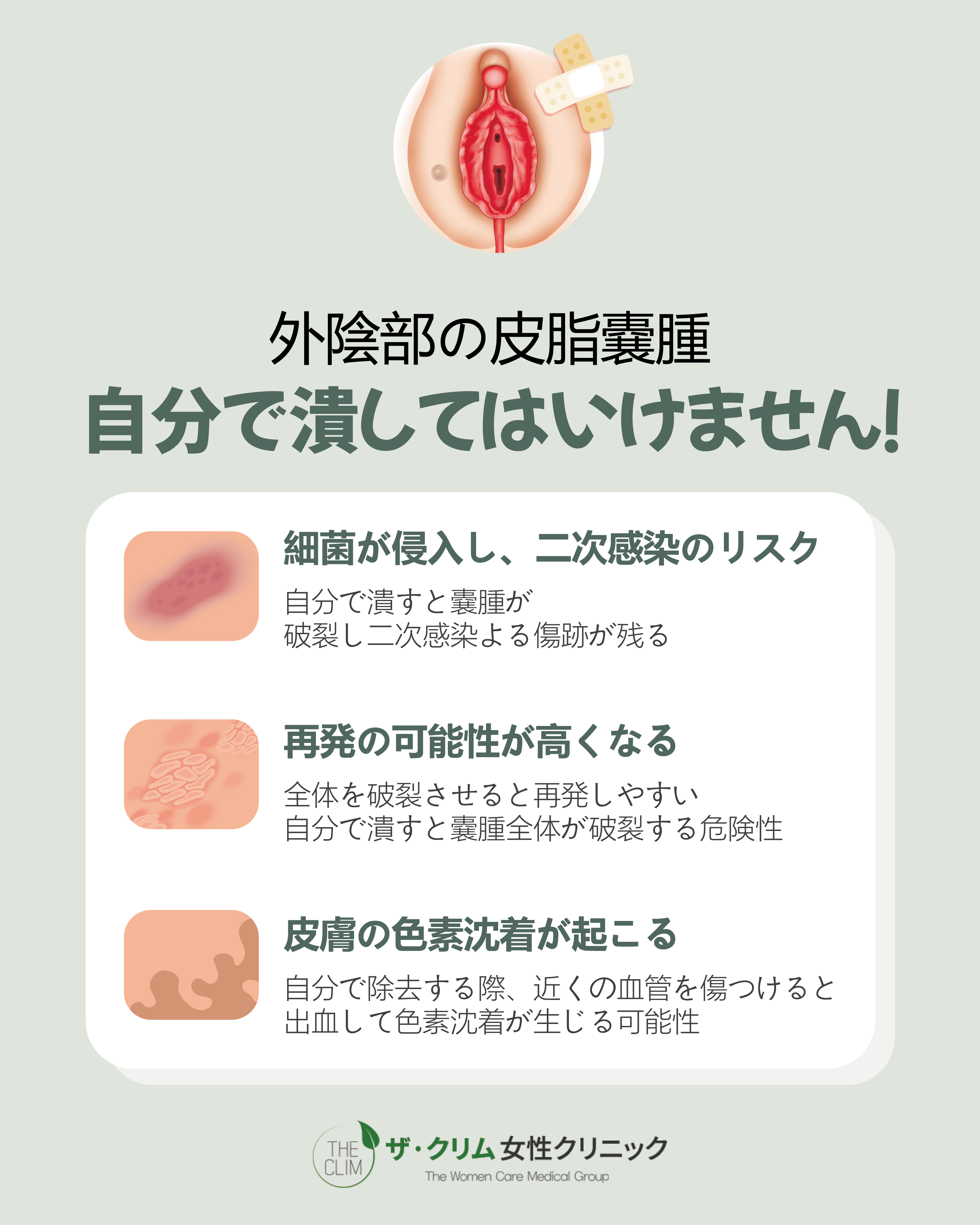 デリケートゾーンに「できもの」が これは病気？しこりやブツブツの原因と対処法 医師監修- ワタファク