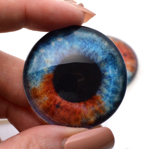 虹彩異色症 - Wikipedia