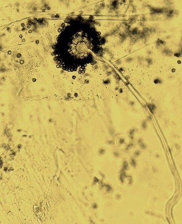 玉ねぎの病気について知っておくべきこと