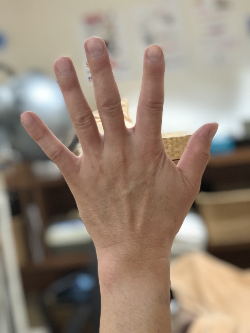 虫様筋 手 高津整体院