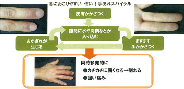 高校時代からの慢性腰痛を克服！腰痛改善の秘訣と新たな目標BACK AGING バックエイジング 鎌倉由比ヶ浜店