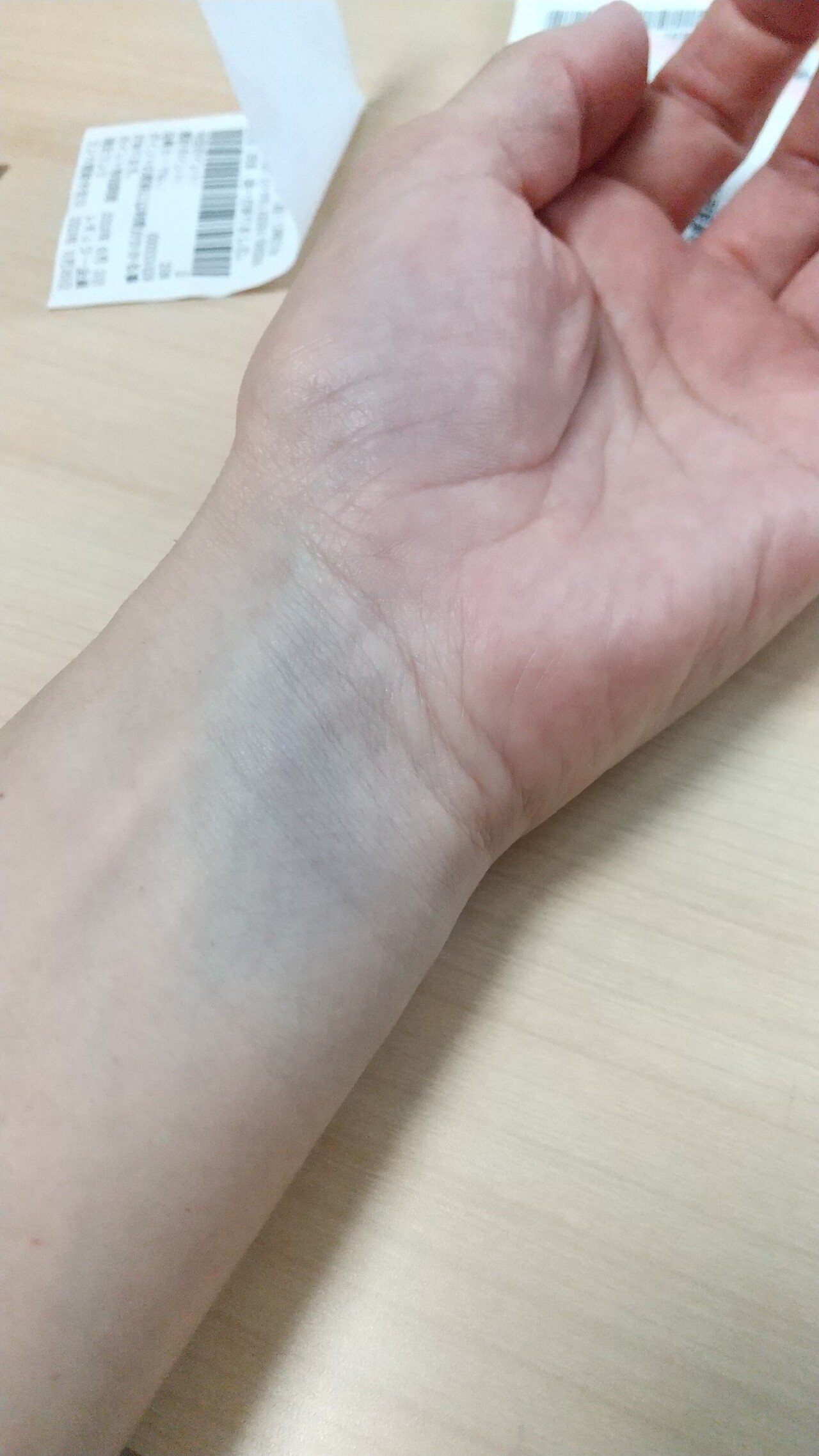 打撲は何科？早く治す方法も。内出血やだんだん痛くなる場合も医師監修Medicalook メディカルック