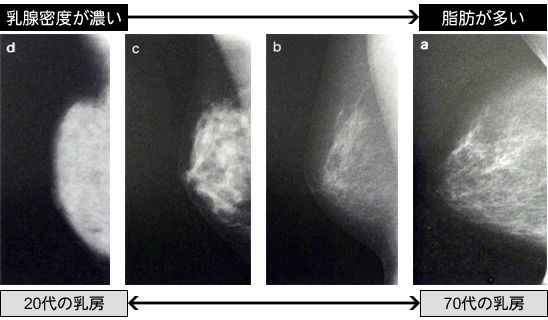 マンモグラフィー – 庄原赤十字病院