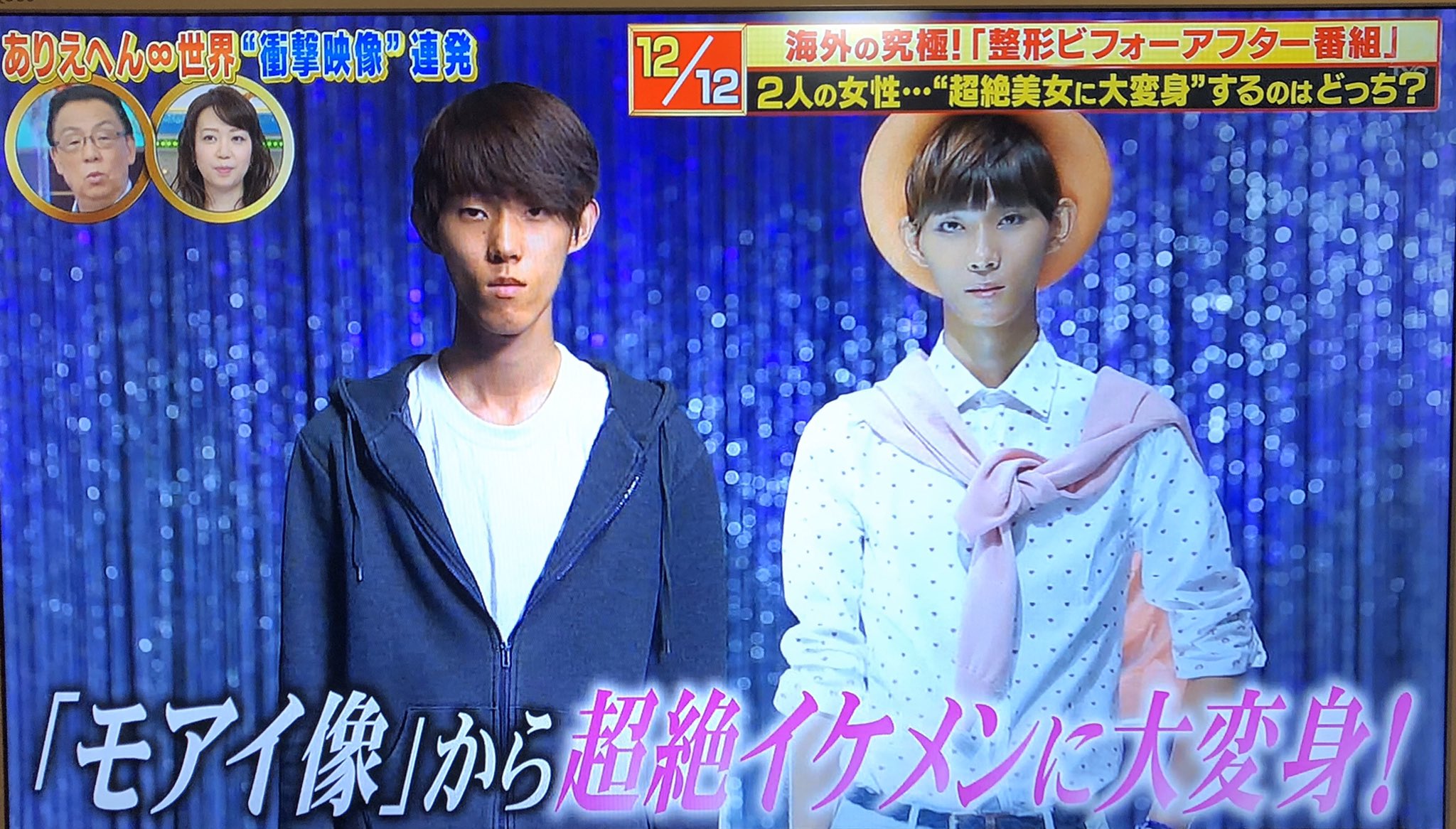 北斗晶：顔面の美容整形に挑戦 「なかよしテレビ」特番で - MANTANWEB まんたんウェブ