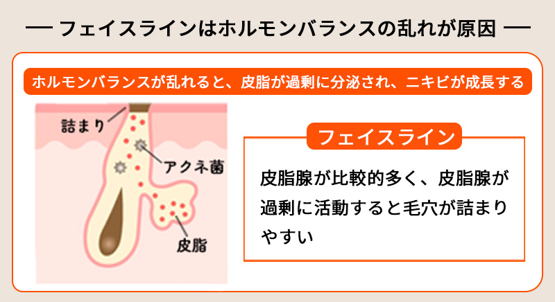 首のニキビや吹き出物の原因と治し方３選